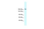 SNRNP200 Polyclonal Antibody