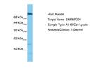 SNRNP200 Antibody in Western Blot (WB)