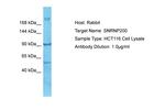 SNRNP200 Antibody in Western Blot (WB)
