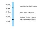 SPRR2A Polyclonal Antibody