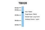 TBX20 Polyclonal Antibody