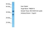 TMEM116 Polyclonal Antibody