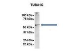 TUBA1C Antibody in Immunoprecipitation (IP)