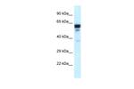 TUBA1C Antibody in Western Blot (WB)