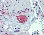TUBB2A Antibody in Immunohistochemistry (IHC)