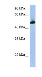 TUBB2A Antibody in Western Blot (WB)