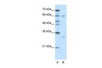 HDBP2 Polyclonal Antibody