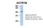 ACTR1B Antibody in Western Blot (WB)