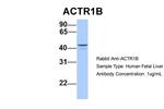 ACTR1B Polyclonal Antibody