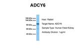 Adenylate Cyclase 6 Polyclonal Antibody
