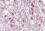 KIAA0317 Antibody in Immunohistochemistry (IHC)