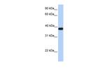 ASB5 Polyclonal Antibody