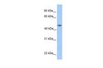 ASB6 Polyclonal Antibody