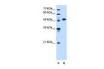 ATP Synthase beta Antibody in Western Blot (WB)