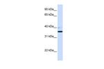 B3GALT1 Antibody in Western Blot (WB)