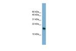 BATF3 Antibody in Western Blot (WB)