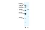 BRD9 Antibody in Western Blot (WB)