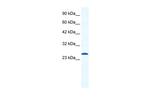 CACNG6 (extracellular) Polyclonal Antibody