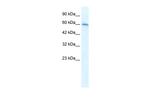 CHRNA7 Polyclonal Antibody