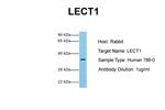 LECT1 Polyclonal Antibody