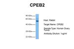 CPEB2 Antibody in Western Blot (WB)