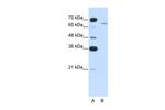 CPEB2 Polyclonal Antibody
