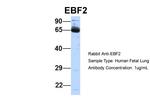 EBF2 Polyclonal Antibody