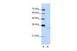 EXOSC6 Polyclonal Antibody