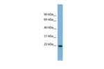 FNDC4 Polyclonal Antibody