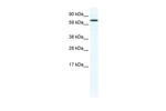 FOXO6 Polyclonal Antibody