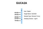 GUCA2A Antibody in Western Blot (WB)