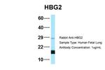 HBG2 Antibody in Western Blot (WB)