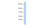 ISCA2 Polyclonal Antibody