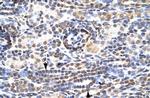 KLF9 Polyclonal Antibody