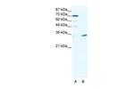 MAGEA9 Polyclonal Antibody