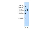 MKRN1 Polyclonal Antibody