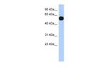 MPP7 Polyclonal Antibody