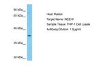 NCEH1 Polyclonal Antibody