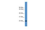SDOS Polyclonal Antibody