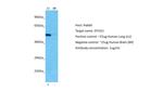 OTUD1 Polyclonal Antibody