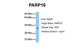 PARP16 Antibody in Western Blot (WB)