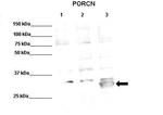 PORCN Polyclonal Antibody