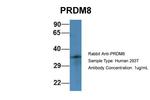 PRDM8 Antibody in Western Blot (WB)