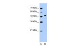 PRR5L Polyclonal Antibody