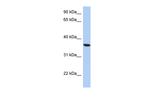 PSTK Polyclonal Antibody