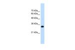 RNF121 Antibody in Western Blot (WB)