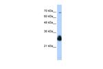 RNF138 Antibody in Western Blot (WB)