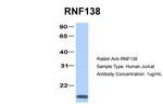 RNF138 Antibody in Western Blot (WB)