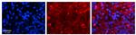 SLC27A6 Polyclonal Antibody