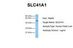 SLC41A1 Polyclonal Antibody